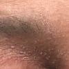 Customer photo for "I deeply regret putting this on my face."