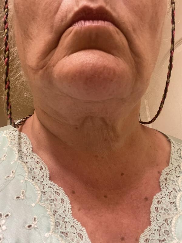 Customer photo for "Disappointing"
