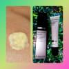 Customer photo for "Say Goodbye to Hyperpigmentation"