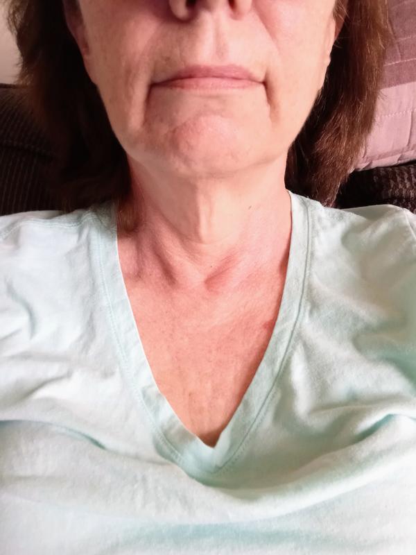 Customer photo for "Impressed with the results!"