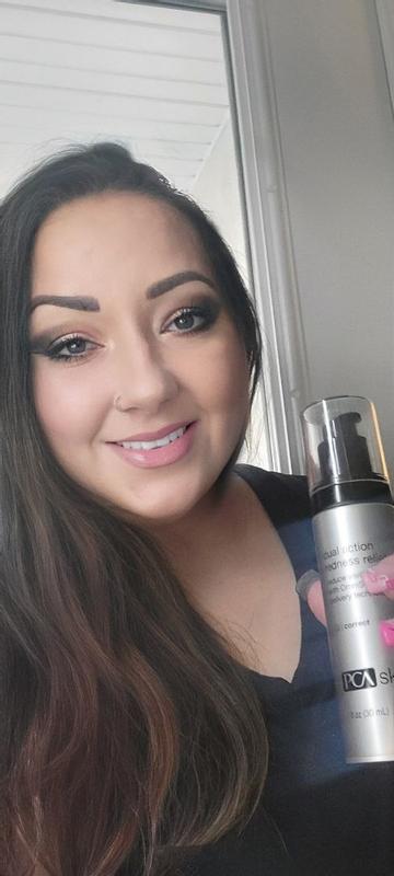 Customer photo for "It will take down your redness"