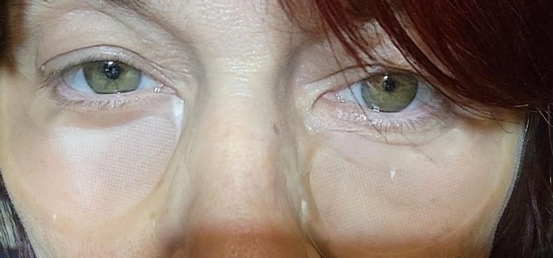Customer photo for "How well these really work."