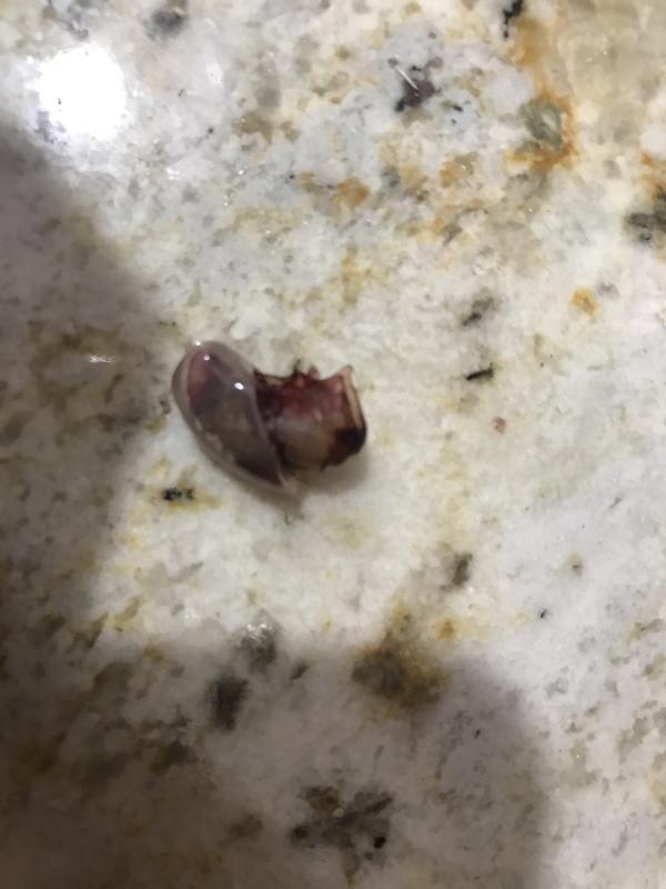 My labs toe nail