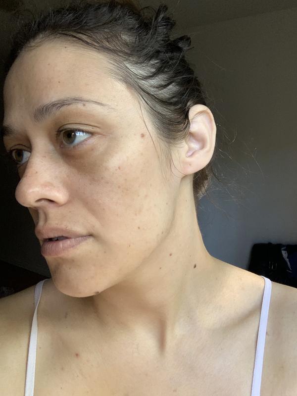 These were taken about 3 months apart