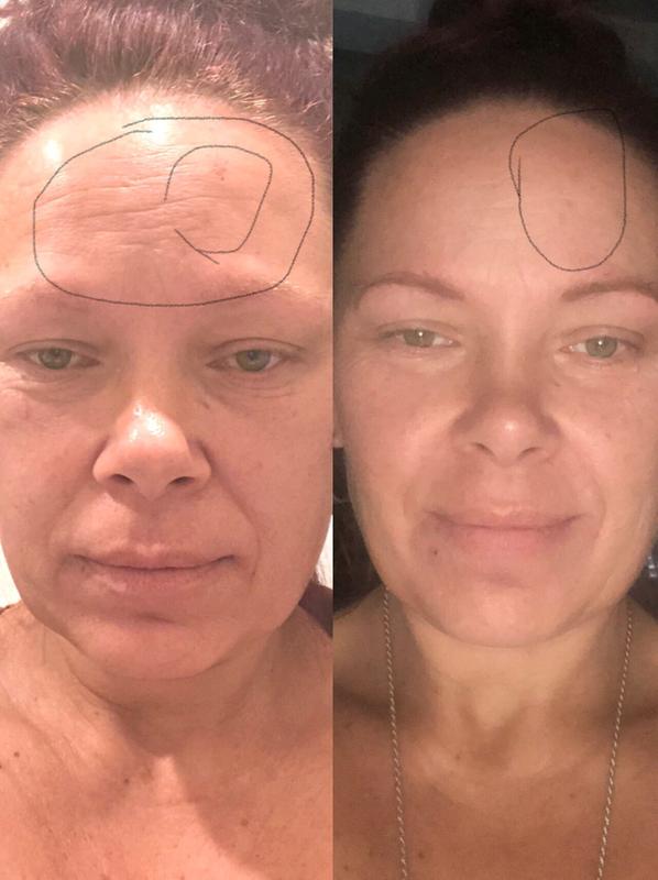 peter thomas roth glycolic acid cleanser