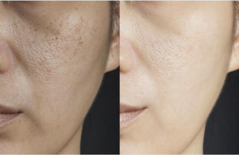 Before and after is MAJOR