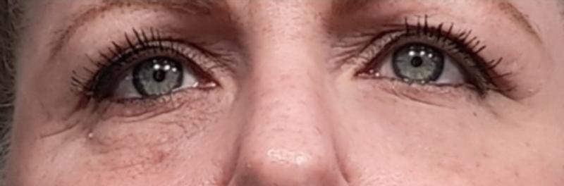 Put cucumber eye patch ONLY ON RIGHT EYE