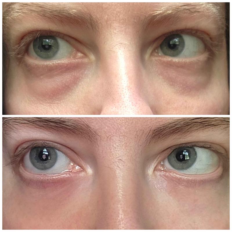 Top: Before Bottom: After