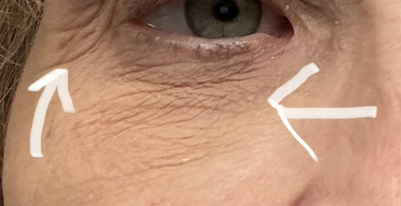 Customer photo for "My eyes looked worse at the end of the day"