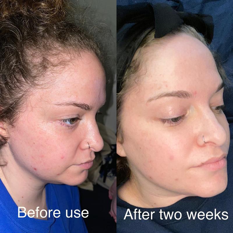 Review Thumbnail Image 0 254129308