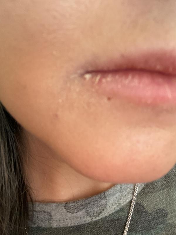 Lip area