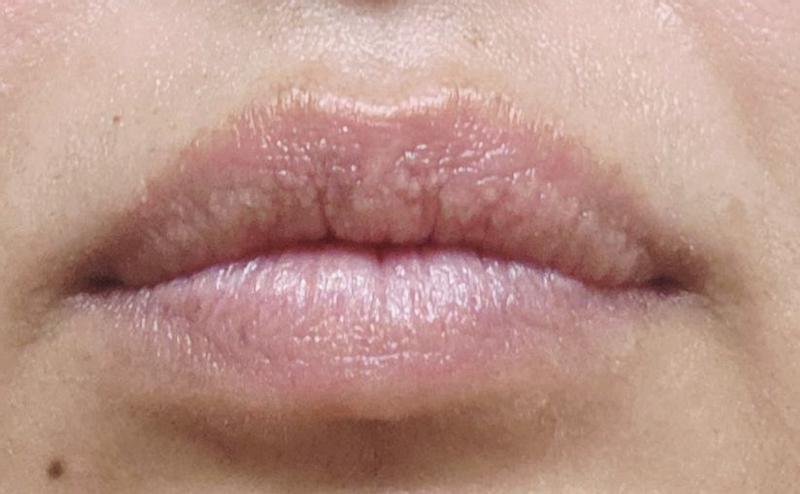 Customer carousel item 11.