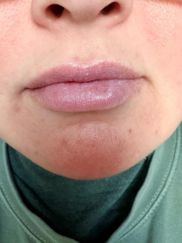 Customer carousel item 3.