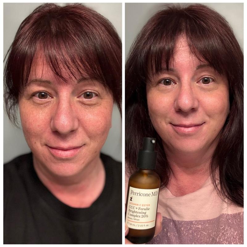 Customer photo for "Brighter and more even skin tone"