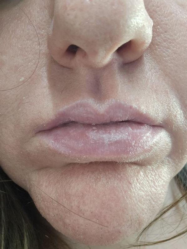 Customer carousel item 12.