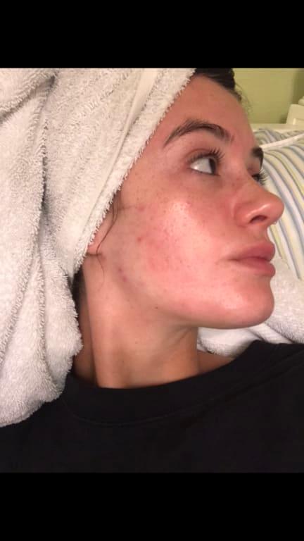 Customer photo for "I liked this cleanser a lot!"