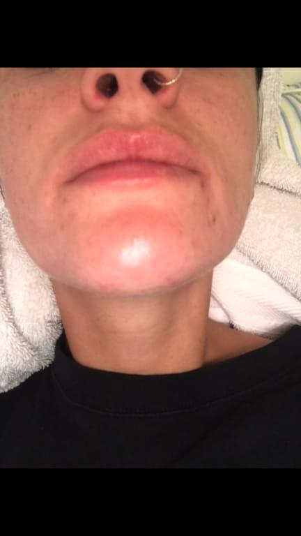 Customer photo for "I liked this cleanser a lot!"