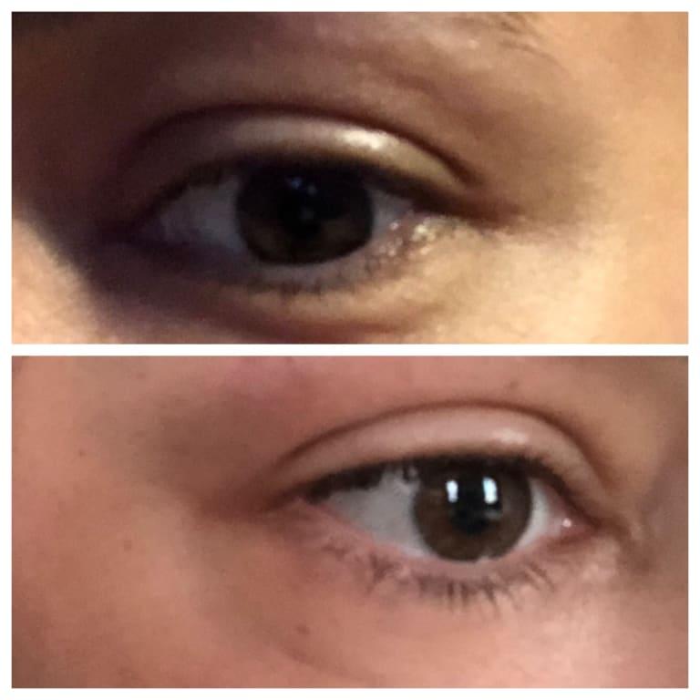 Top before. Bottom after 1 week.