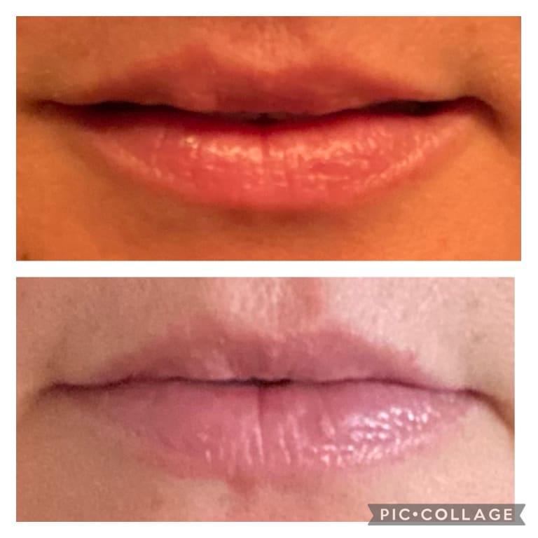 Before above/After below