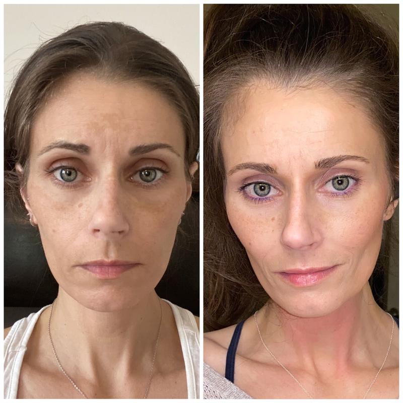 Approximately 7 months apart