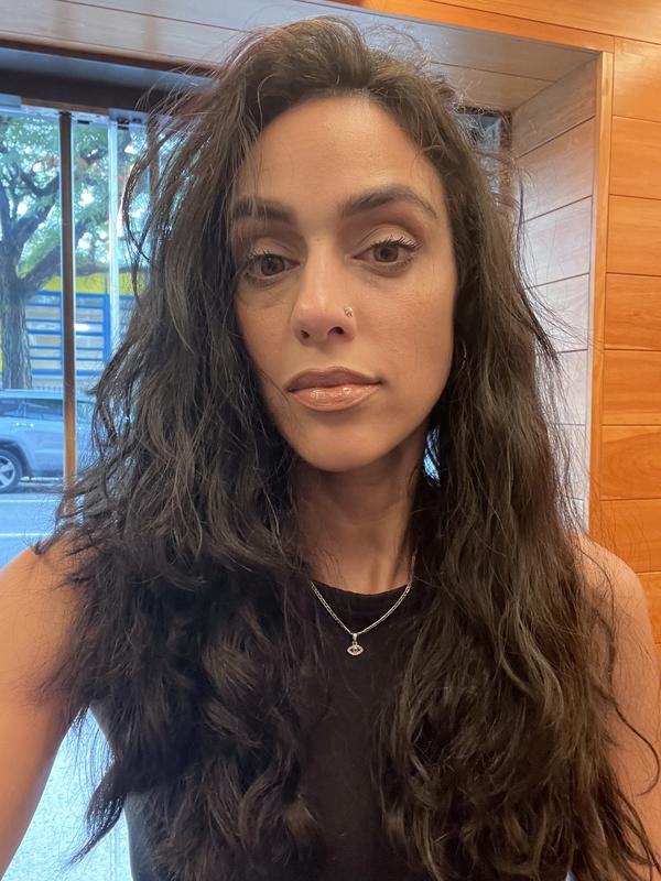 Before: You can see the puffiness and darkness even with make up.