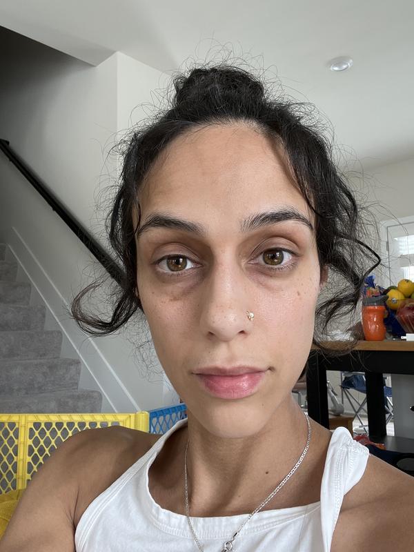 After: took this pic just for the review. No make up, no filter a lot of sunlight and messy mommy bun. Huge difference.