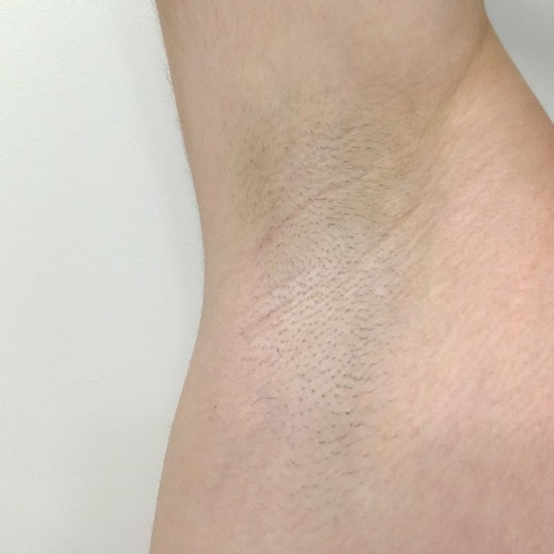 Customer photo 2 of 2. Click to open full size image.