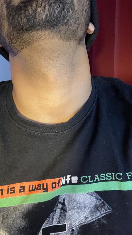 Edge precision with 360 blade - Under the chin