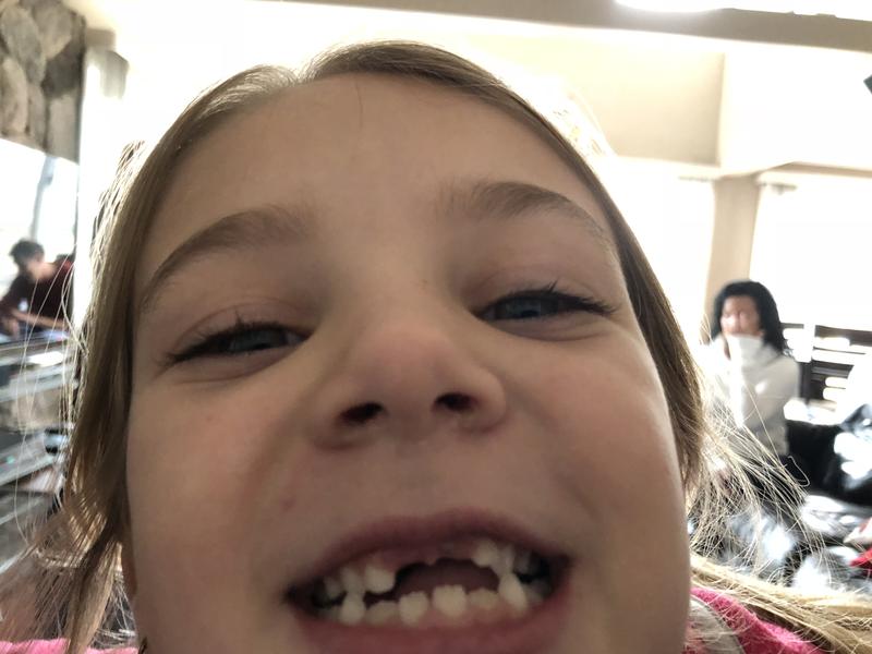 What could be cuter than a missing tooth