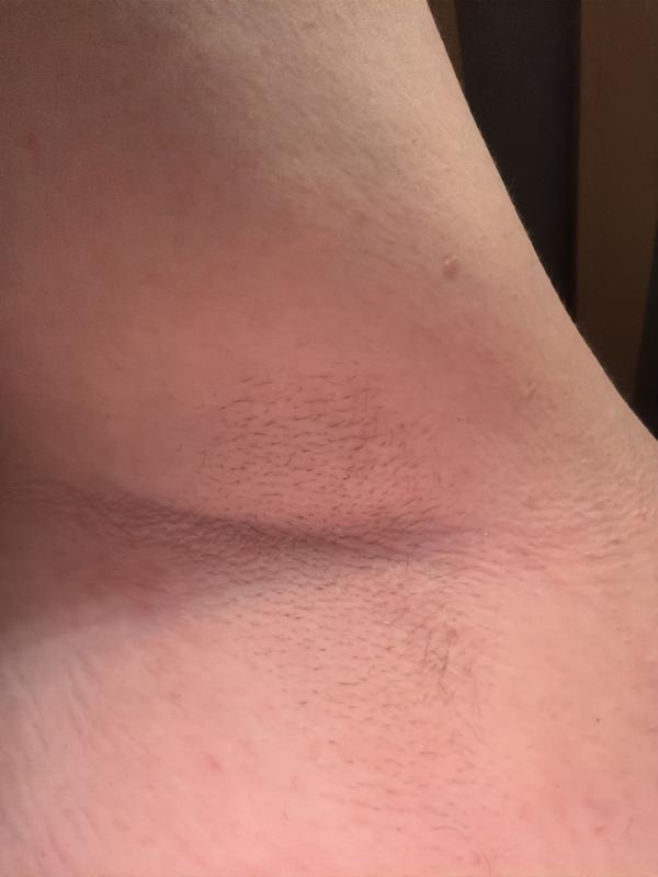 Armpit After use