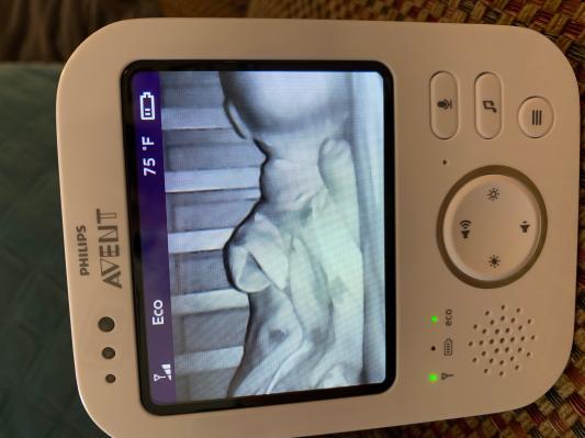 Contrast helps me to see baby is breathing