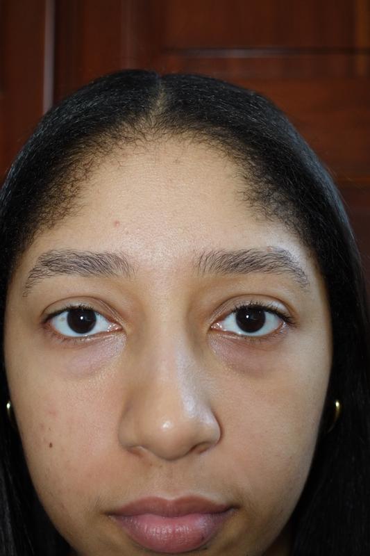 Review Thumbnail Image 2 382534761