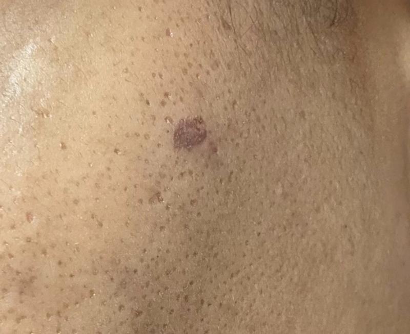 Review Thumbnail Image 1 386512120