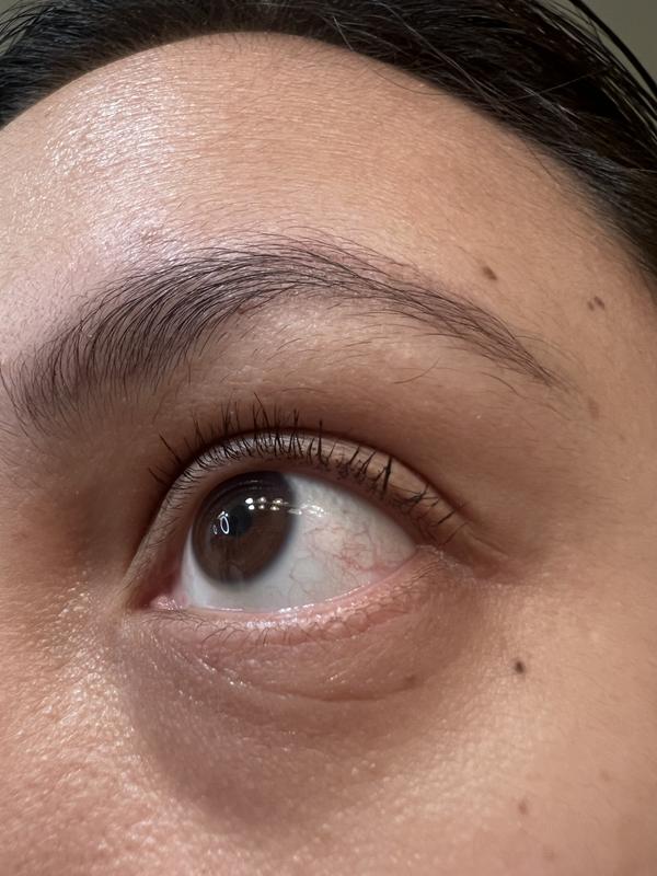 Before & after photos