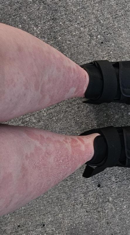 Legs September 2024