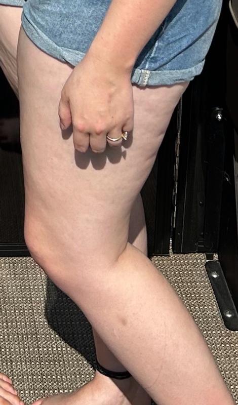 Review Thumbnail Image 0 380168359