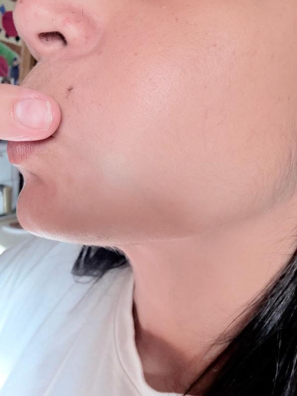 Customer photo for "I absolutely loved this serum, it left my skin glo"