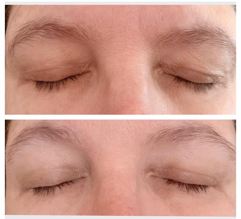 Review Thumbnail Image 1 369571018