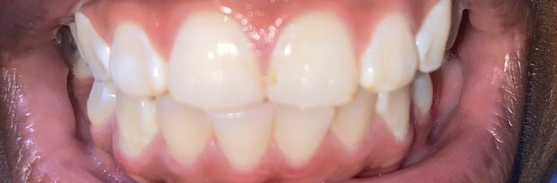 Review Thumbnail Image 1 361800303