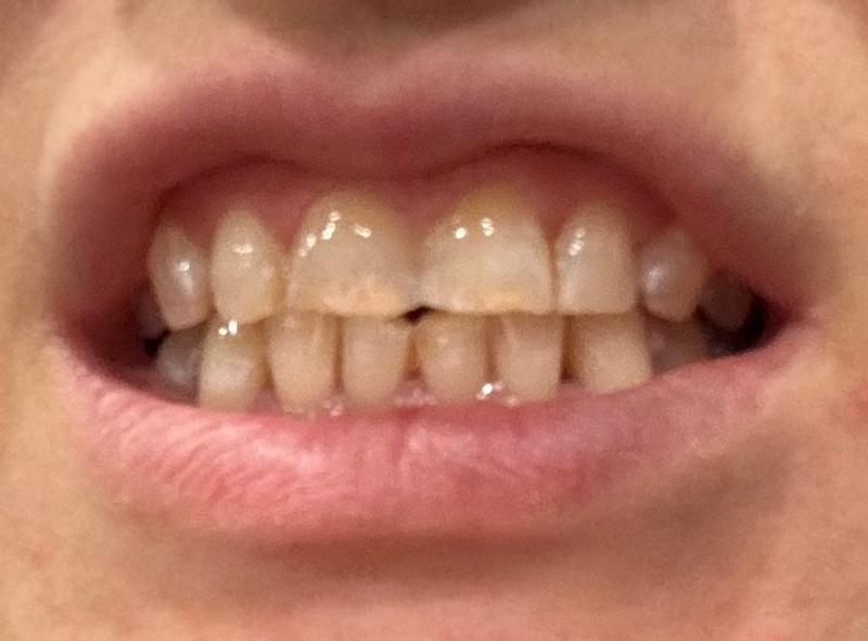 Review Thumbnail Image 0 379894857