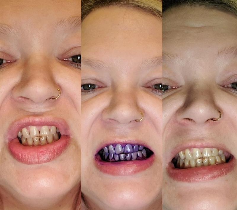 Review Thumbnail Image 0 379257786