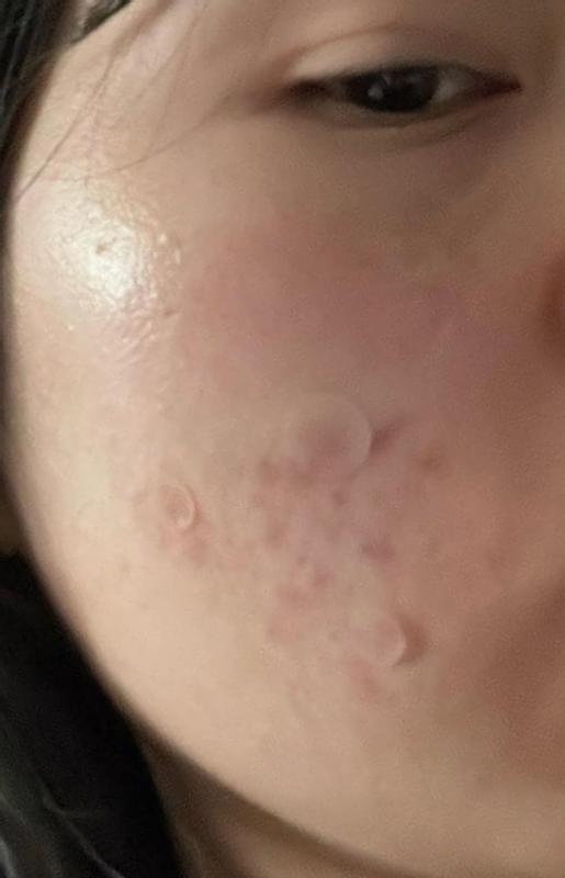 Review Thumbnail Image 0 360189851