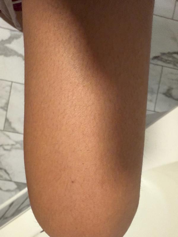 Review Thumbnail Image 0 380417978