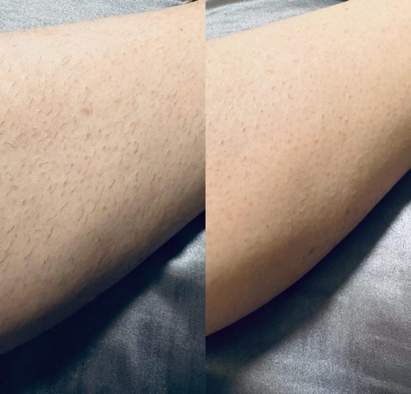 Review Thumbnail Image 2 382012866