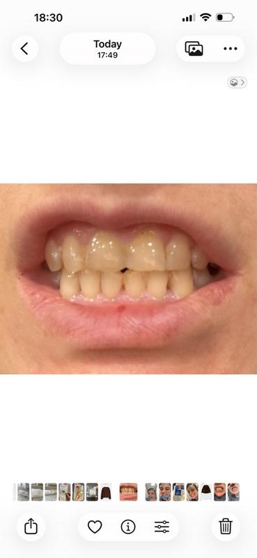 Review Thumbnail Image 2 379894857