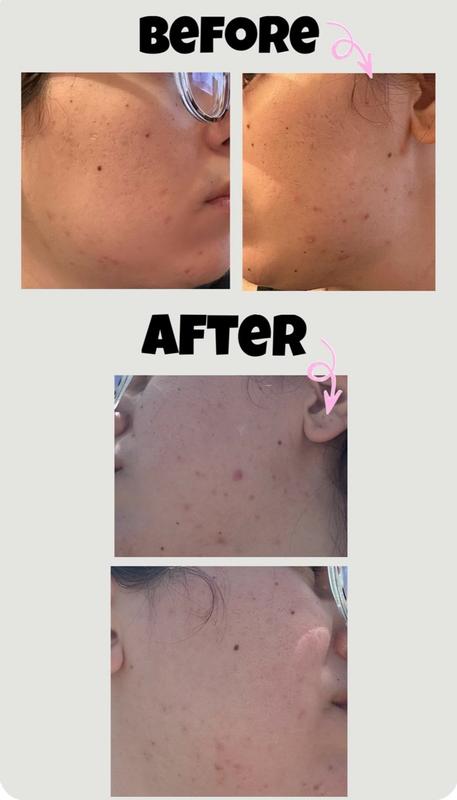 Customer photo for "Takes times and use sunscreen!!"