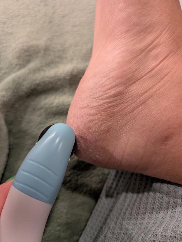 Review Thumbnail Image 2 381471658