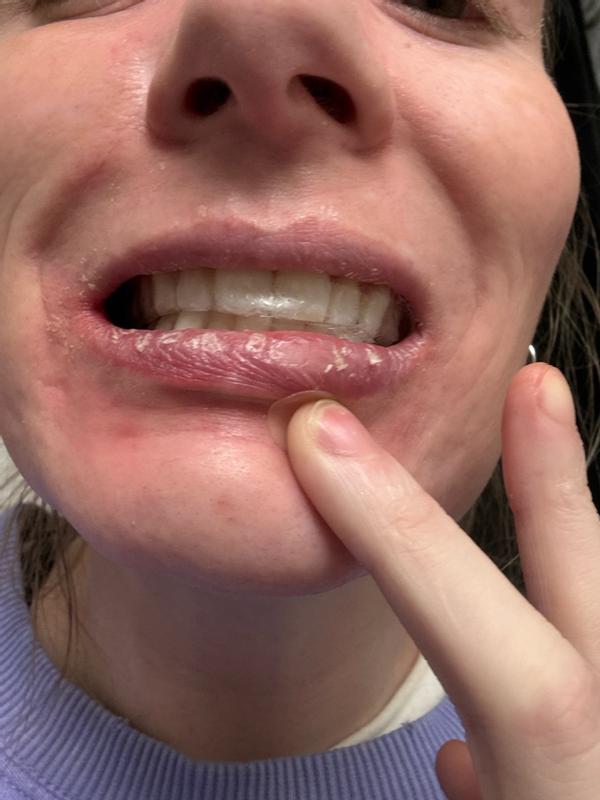 Review Thumbnail Image 0 377381668