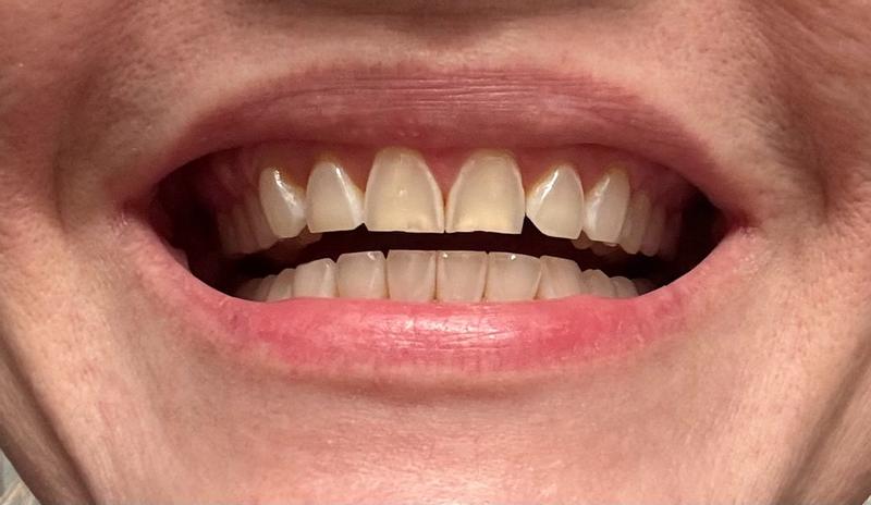 Review Thumbnail Image 1 377225714