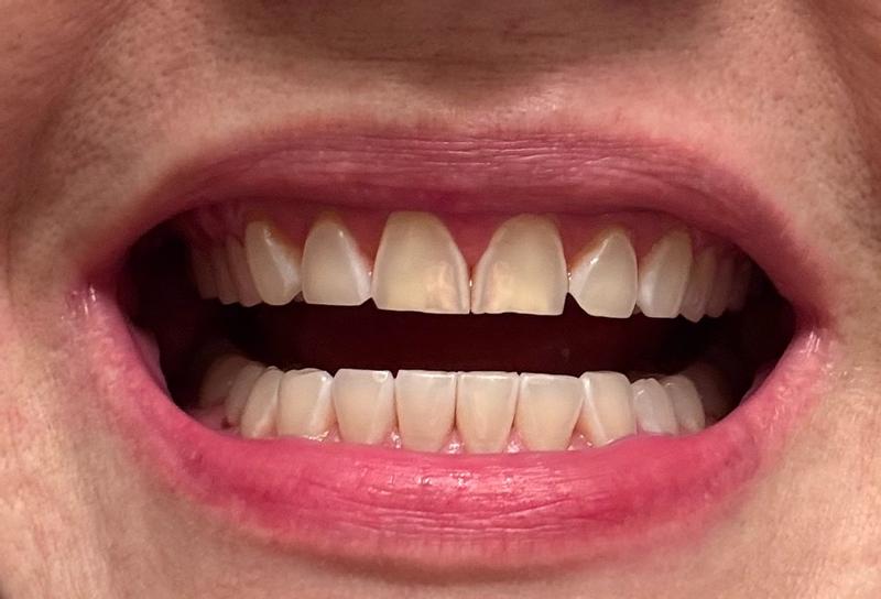 Review Thumbnail Image 2 377225714